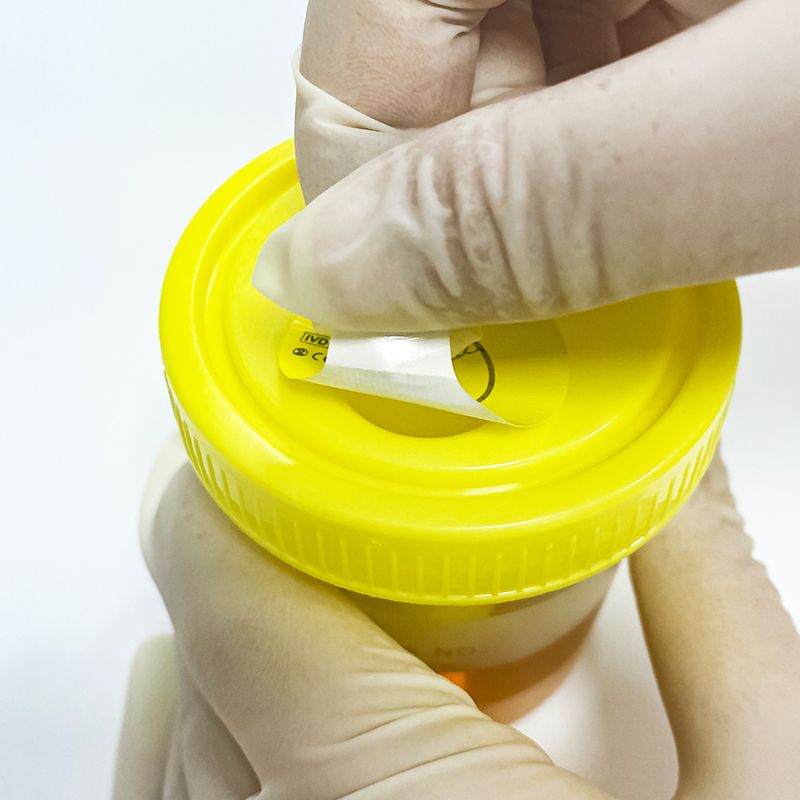 urine sample container lab