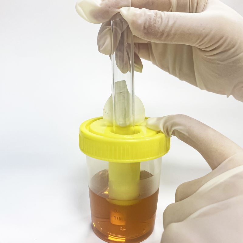 universal urine container lab